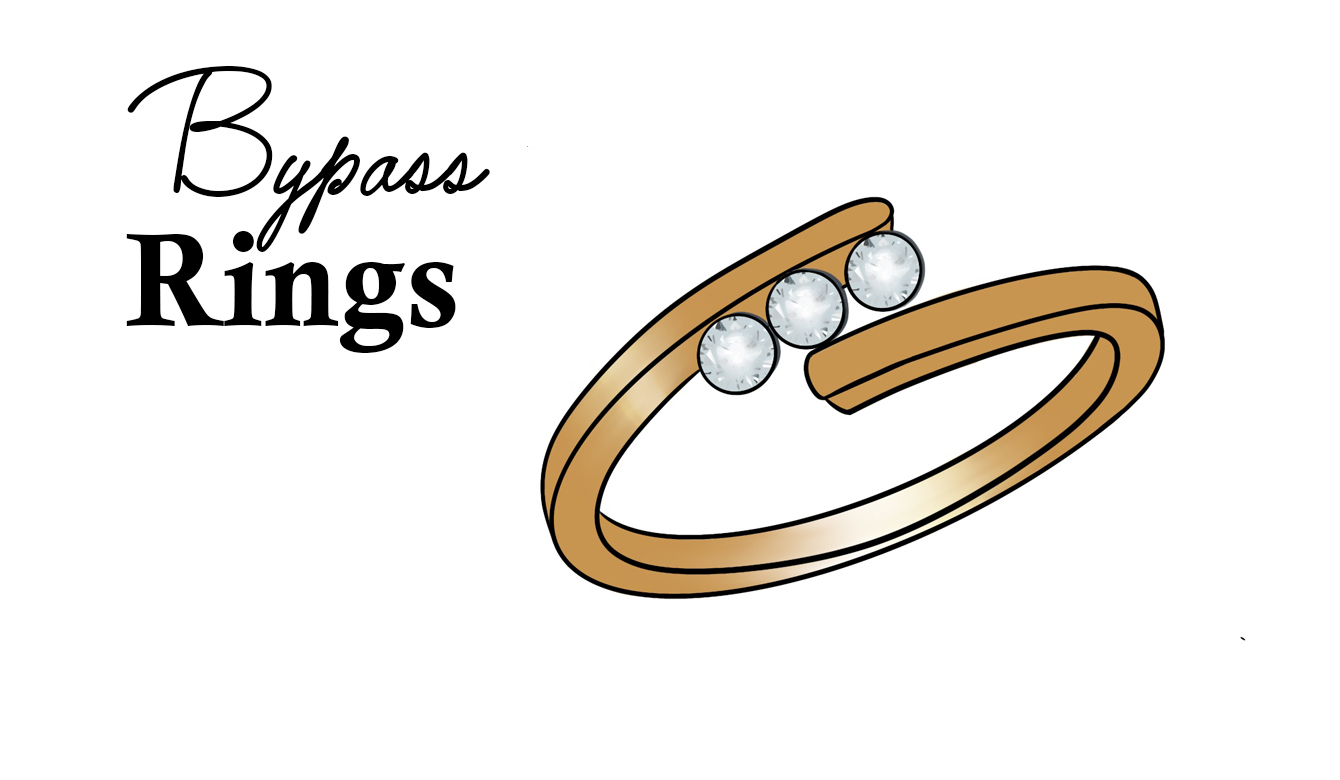 Bypass Rings